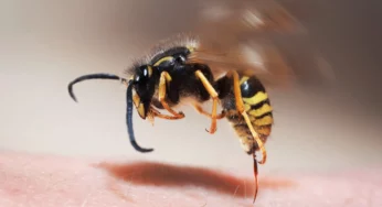 Что делать, если ужалила пчела или укусила оса?